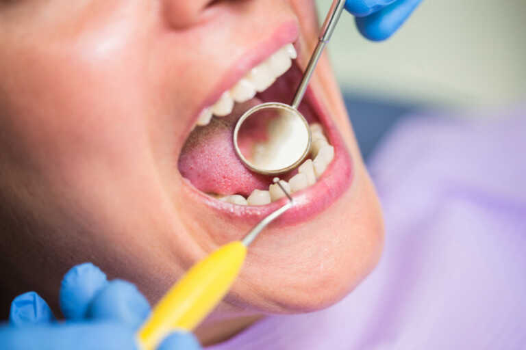 Coroa dental dentista